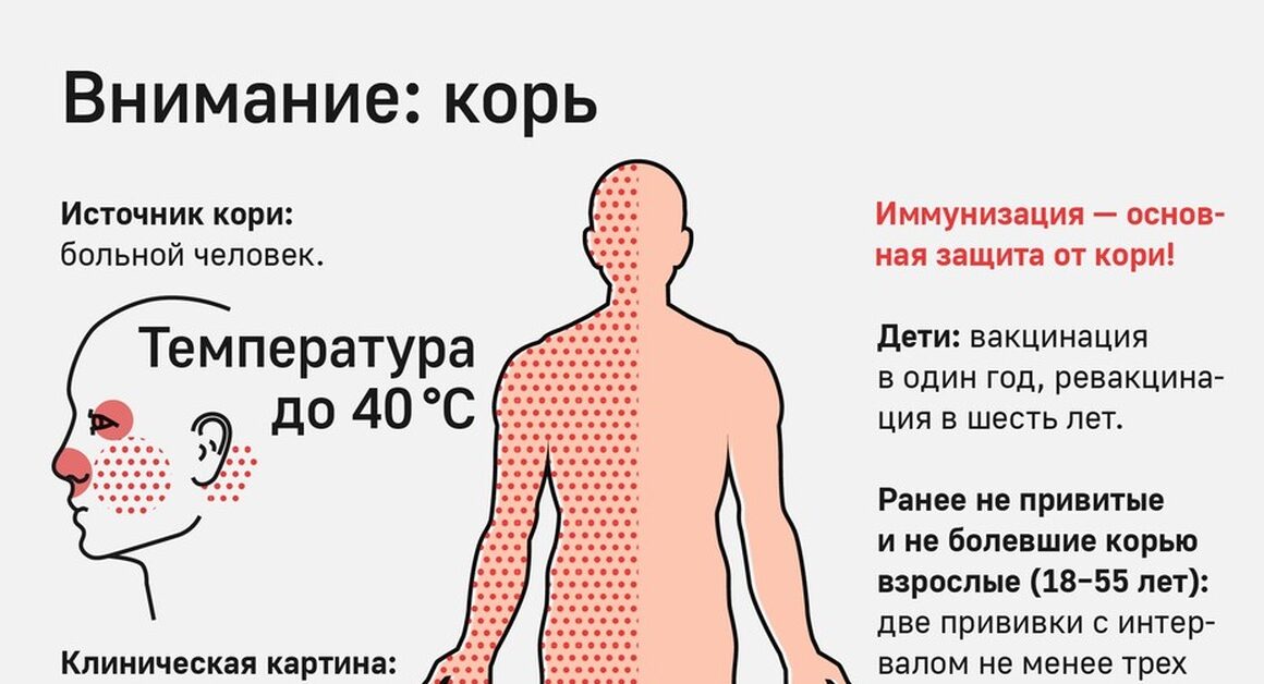 Внимание, корь!